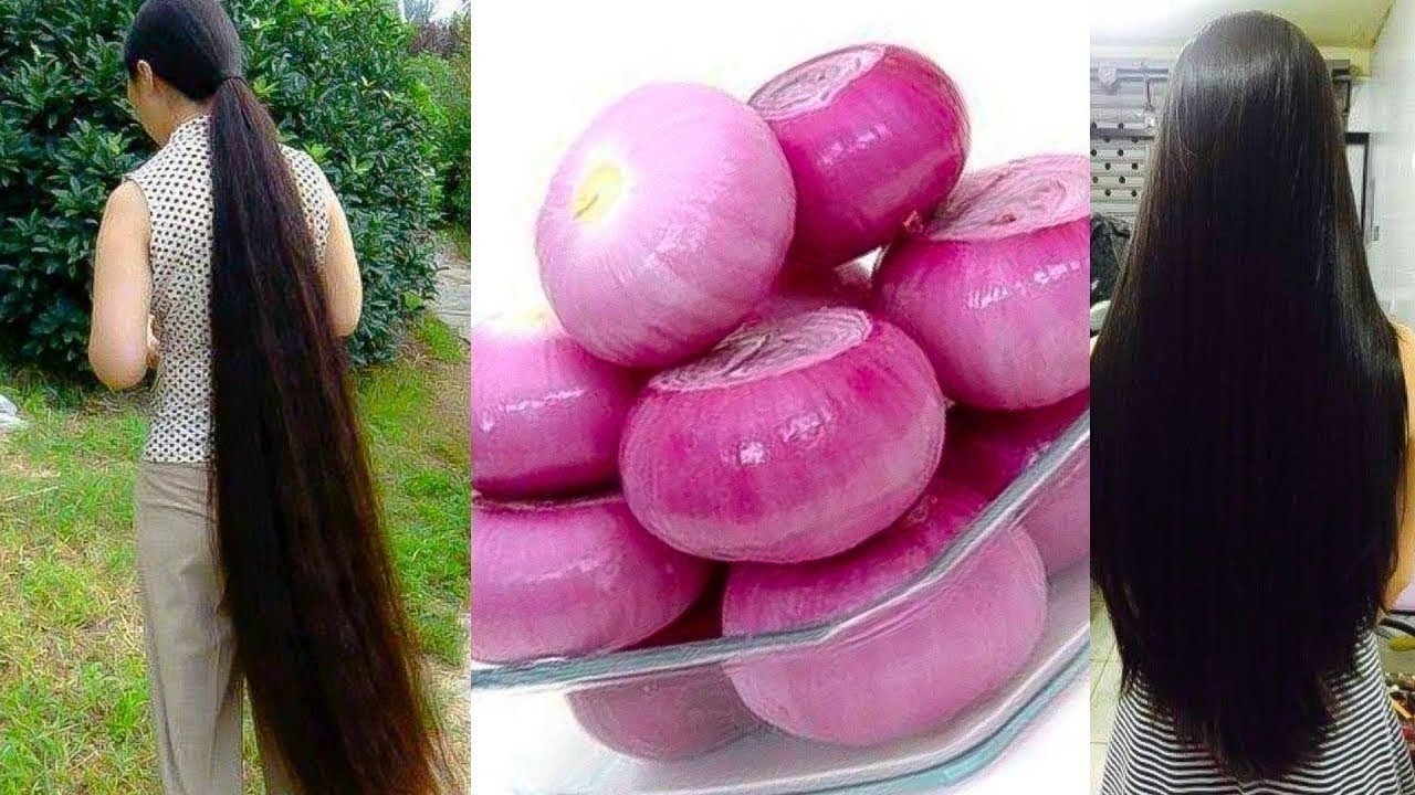 Red Onion Hair oil Faster hair growth in 15 days How to grow hair