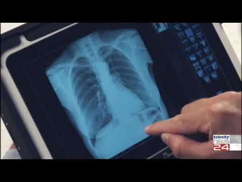 23/03/21 - Ovada: arriva la radiologia a domicilio