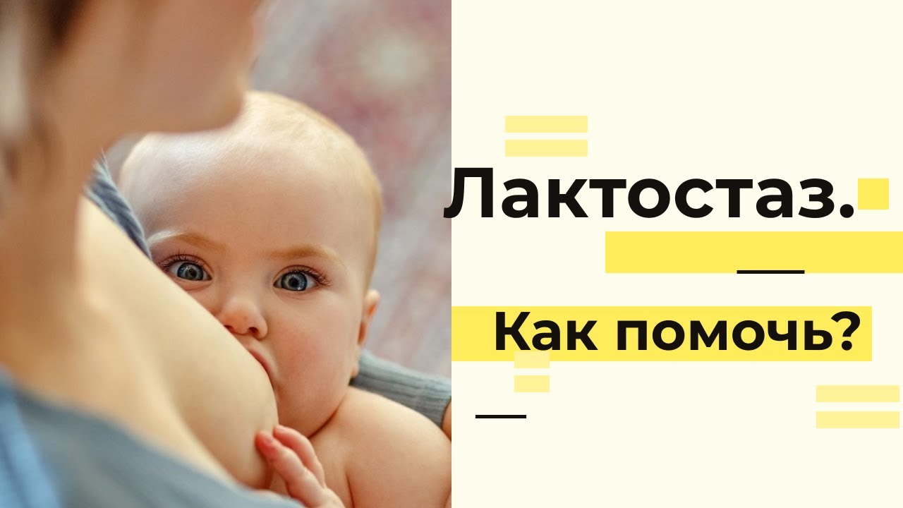 Лактостаз. Снимаем боль и уменьшаем отек. - YouTube