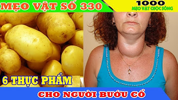 Người bị bướu cổ nên ăn gì? II 6 Thực phẩm tốt nhất cho người bị bướu cổ