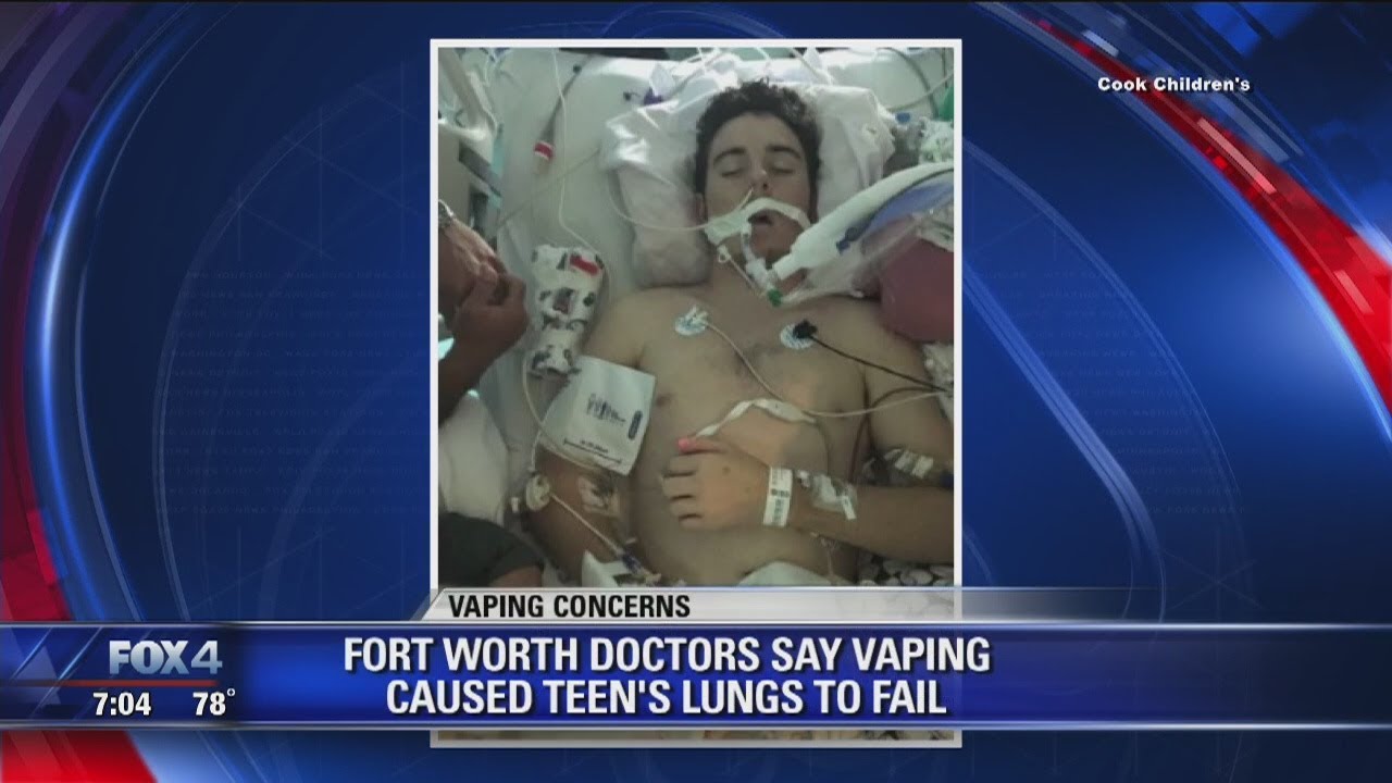 Doctors say vaping caused teen's lungs to fail