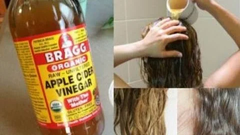 ¿Qué ocurre si te pones vinagre de sidra de manzana en el pelo?