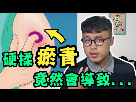 硬揉瘀青竟然會導致這樣的結果！？【三個字SunGuts】