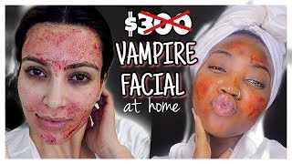 VAMPIRE FACIAL AT HOME | SKIN MICRONEEDLING | BANISH SKINCARE