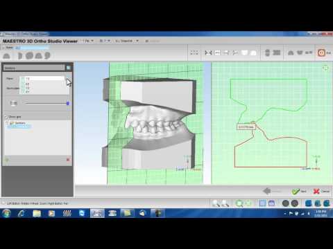 Maestro 3D Ortho Studio Viewer 1.4 Tutorial