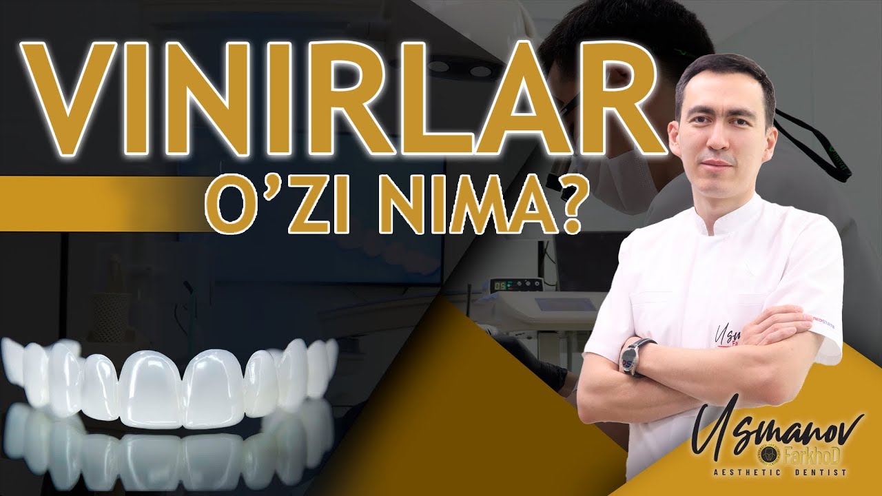❓Vinirlar o'zi nima