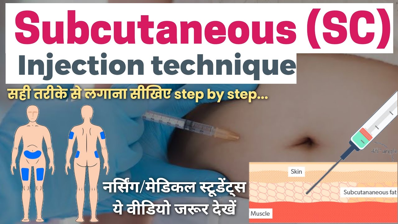 Subcutaneous (SC) Injection Technique || SC injection कैसे लगाते है ...
