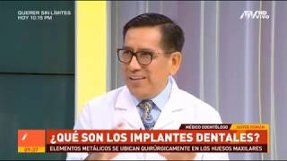 Implantes Dentales en 1 cita.