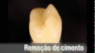 Microjato Bio-Art