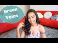 How To Get Rid of Green Veins + What Causes Green veins