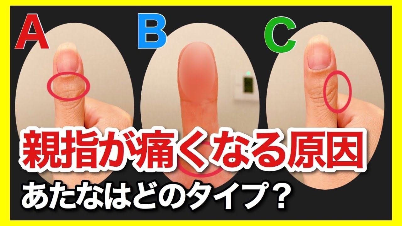 なぜ親指が痛くなるのか？