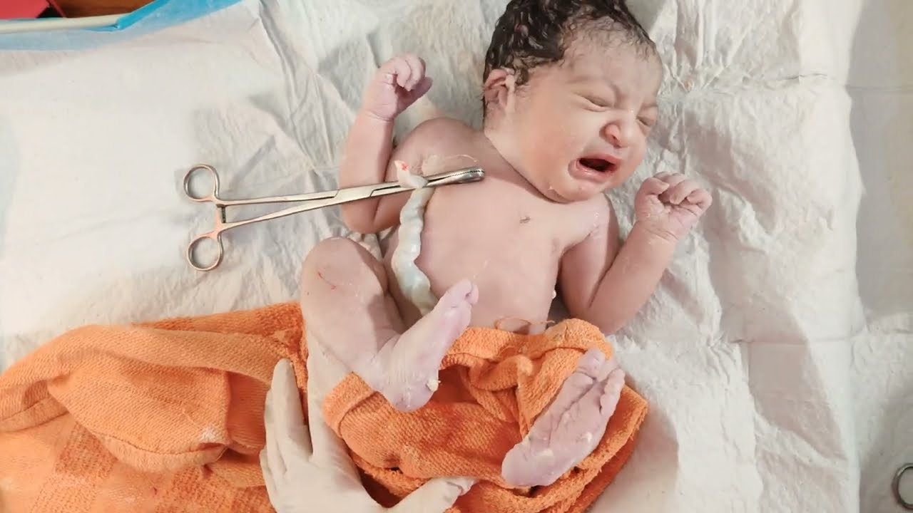 White Cheese vernix Caseosa On Big Newborn Baby Just After Birth White Cheese vernix Caseosa On Big Newborn Baby Just After Birth