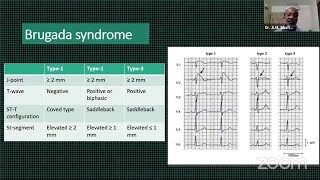 Lecture 34: ECG in Clinical Practice