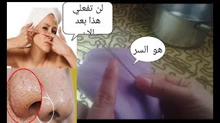 تنظيف البشره من الرؤس السوداء زي الكوافير بنص جنيه بأقل التكلفه والنتيجه هتبهرك .