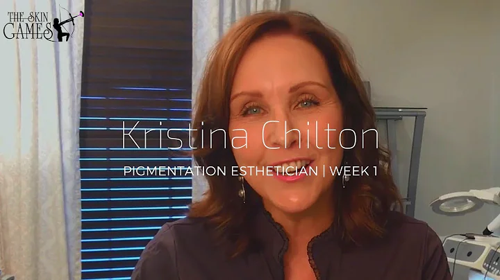 TSG2018 | Kristina Chilton | Pigmentation | Week 1