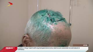 Хозяину собак, покусавших пожилого человека, вынесли приговор Хозяину собак, покусавших пожилого человека, вынесли приговор