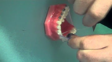 How to use FlossFish