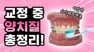 치아교정 중 양치질 방법 [교정용 칫솔 / 치간칫솔] 예쁜미소바른이치과