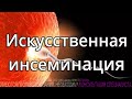 Внутриматочная инсеминация