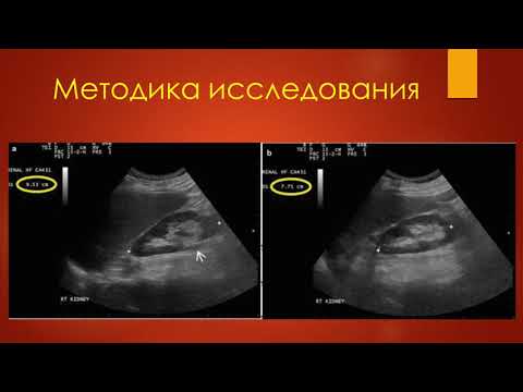 Видео: Можно ли увидеть инфекцию почек на УЗИ?