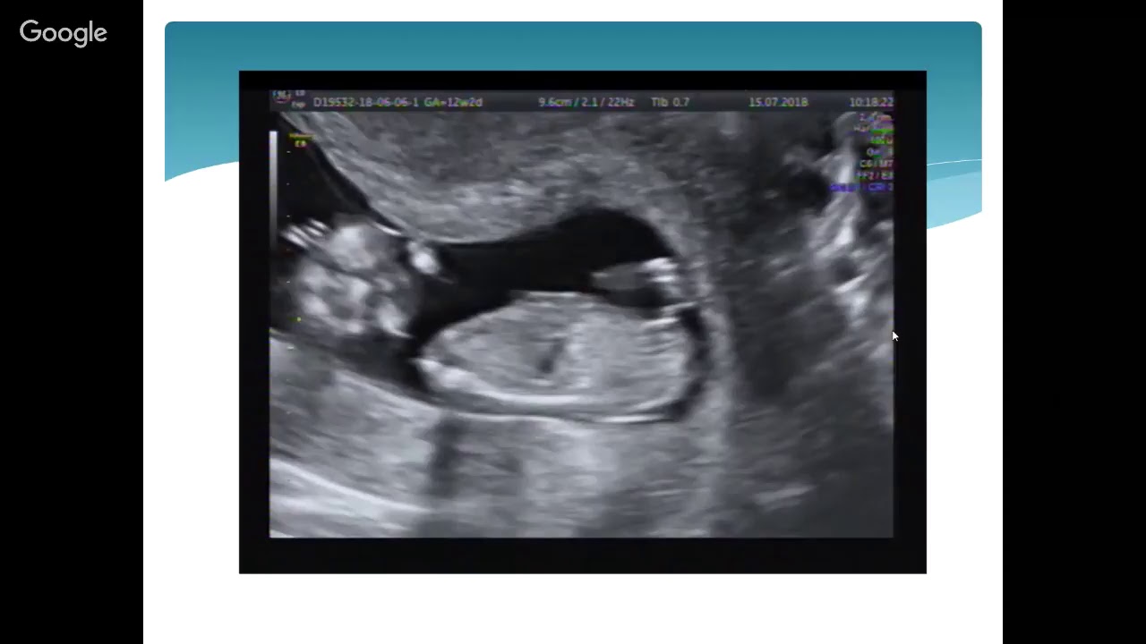 Вебинар для ранних сроков