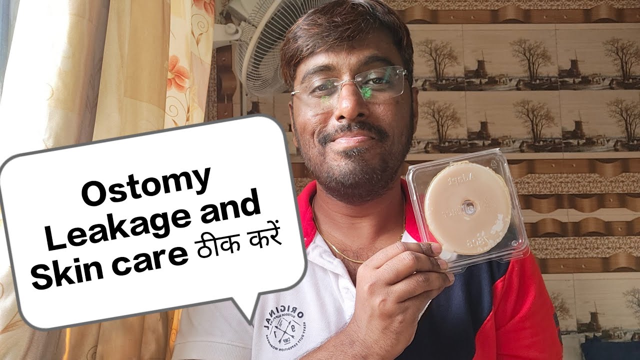 Ostomy Skin ya Ostomy leakage कैसे ठीक करें Colostomy Bag leakage
