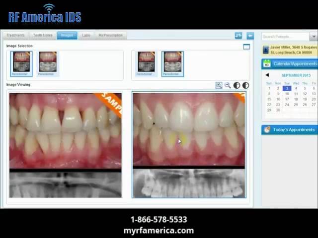 iDentalSoft Practice Management Demo by RF America IDS