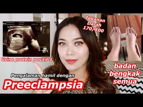 Video: Preeklampsia Teruk: Komplikasi Dan Rawatan