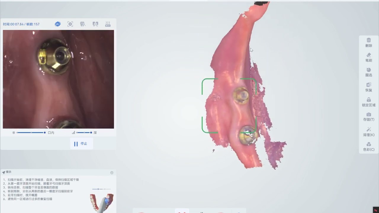 PANDA HAT Scanbody | Scanning Showcase