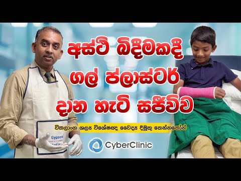 අස්ථි බිඳීමකදී ප්ලාස්ටර් දාන හැටි සජීවිව Cyber Clinic