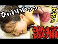 【吸い玉 肩甲骨はがし】瘀血大量発覚 3か月ぶりのメンテ 重症でした肩甲骨を吸い玉と鍼でガッツリ治療 11円で自分でケア出来る方法も伝授【銀座日本橋 横浜元町 鍼灸院】