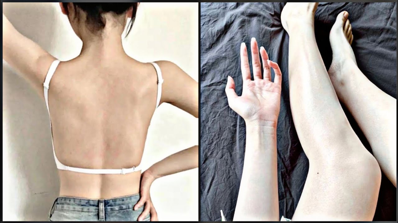 🔮 الكود السري للتجميل | سبليمنال لإزالة السيلوليت والدوالي وعلامات التمدد نهائيًا