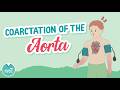 Coarctation of the Aorta - Pediatrics Nursing Review for the NCLEX