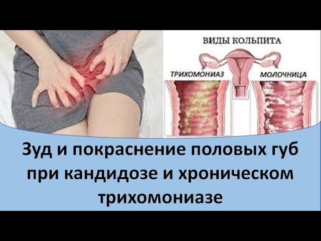 Как изменить форму половых губ? Как изменить форму половых губ?