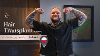 Journey to a new Hairline - Mikolaj Jezierski from Poland