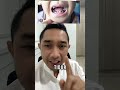 TERLALU EGOIS SEBAGAI ORANG TUA KALO KITA SELALU KASIH PERMEN TANPA METIKAT GIGIKAN SETELAHNYA