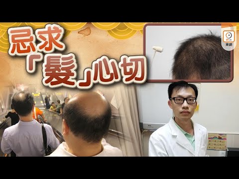 【on.cc東網】Dr.東：盲信偏方增髮　隨時適得其反