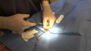 Removing a Tumor Under the Skin: Mast Cell Tumor Cat