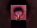 Causes For Dark Lips Dermatologist Dr Jenny Liu SHORTS Causes For Dark Lips Dermatologist Dr Jenny Liu SHORTS