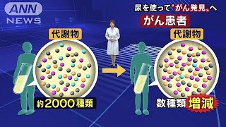 尿を使って「がん」発見へ　日立製作所が技術開発(18/04/16)