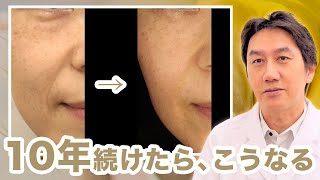 【シワ・たるみ・毛穴治療】肌の再生医療について、他院との圧倒的な違いを解説します