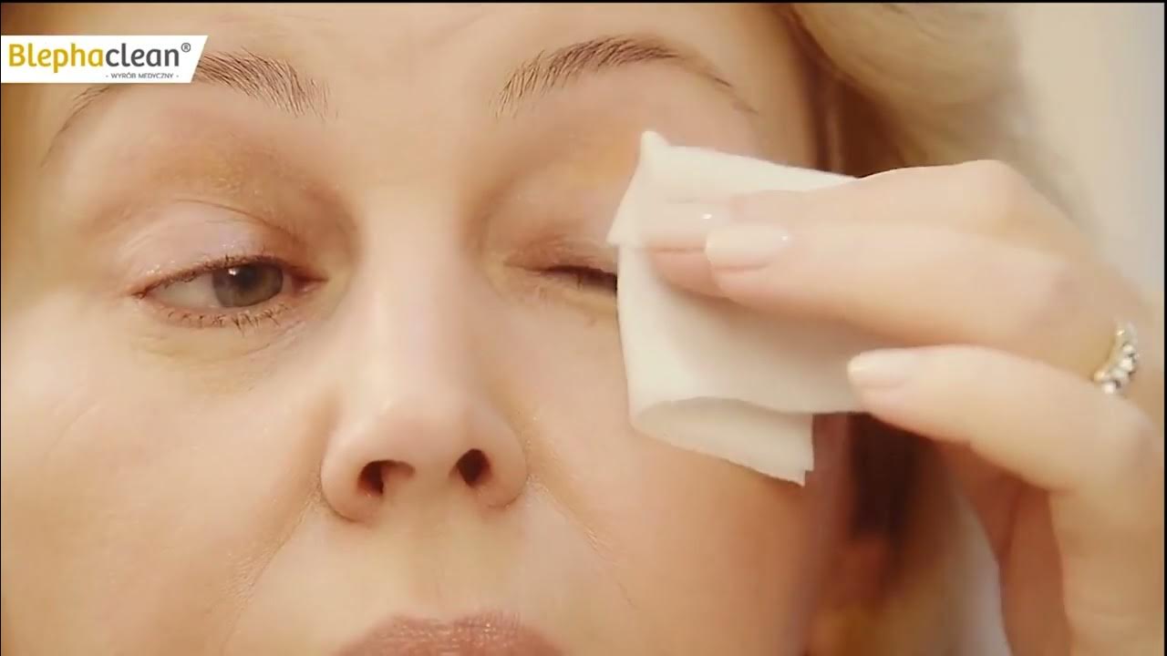 Blephaclean® салфетки для глаз. Как правильно использовать. - YouTube