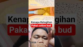 kenapa ketagihan menggunakan cotton bud #shrots #duet #didyouknow