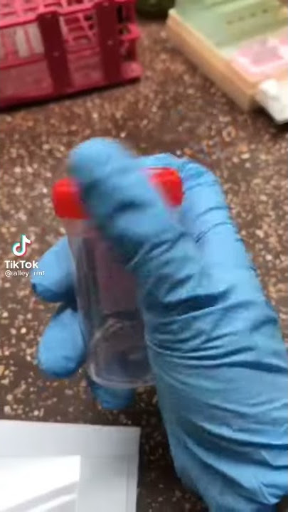 Semen through Microscope-Tiktok