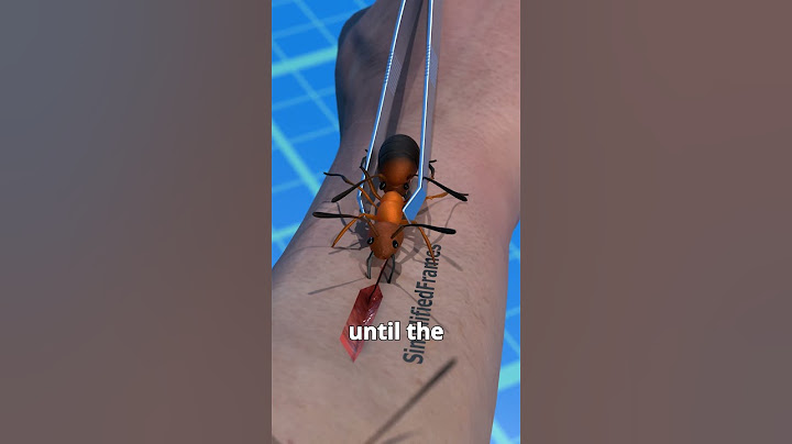 Using ants to stitch Wounds 😱