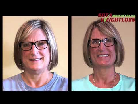 SOTA Weight Loss Before & After Transformations
