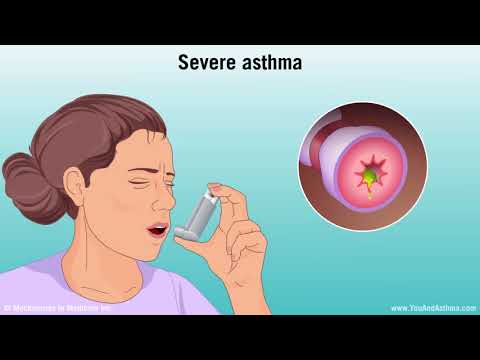 Video: Bylo by astma považováno za stav?