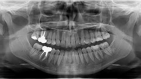Trade up your CS 8100 pan to 3D