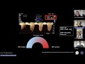 Role of Echo in Pulmonary Hypertension (in the critically unwell)