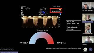 Role of Echo in Pulmonary Hypertension (in the critically unwell)